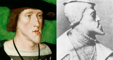 The Habsburg Jaw Reveals Inbreeding In The Most Powerful European Dynasty