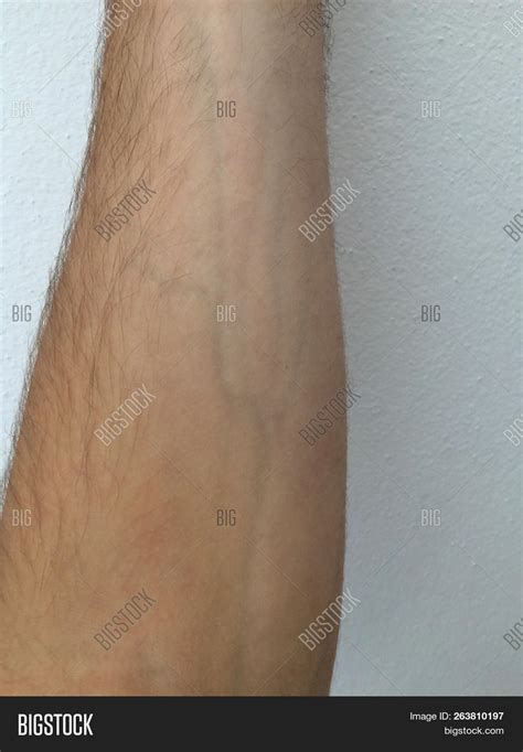 Male Forearm Protruding Veins Hair On The Arm White Skin White