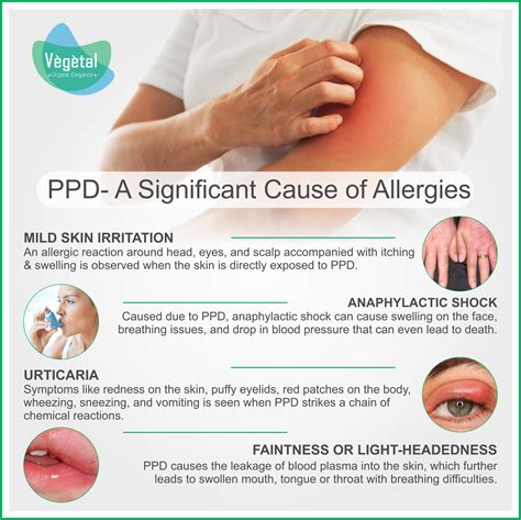 Ppd A Significant Cause Of Allergies Hair Dye Allergy Irritated