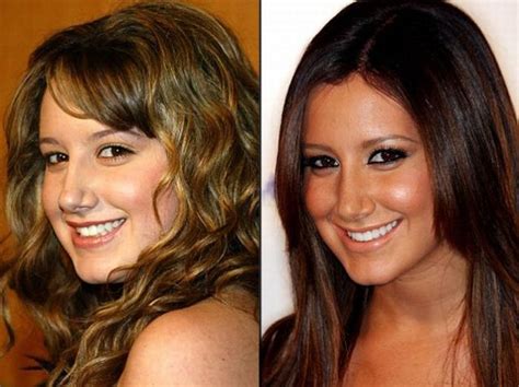 Celebrities Before And After A Plastic Surgery Photos