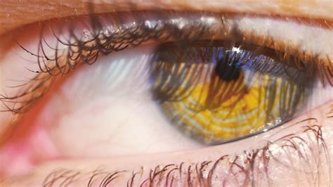 Anorexia Researchers Found Biomarker Link In Eyes The Courier Mail