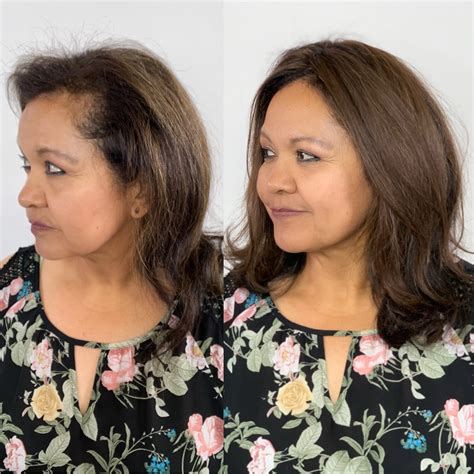 Crown Toppers Solutions For Top Thinning Hair — Spg Extensions And Color
