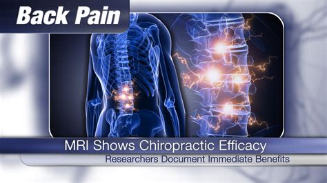 Immediate Benefits Of Chiropractic Adjustments Visible On Mri