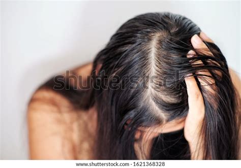 Women Thin Hair There Pulses Hair Stock Photo Edit Now 1621368328