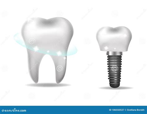 Implantes Dentales Prótesis Estilo 3d Realista Concepto Dental De