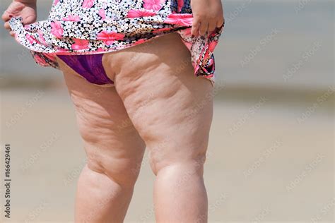 Lively Old Fat Woman In Swimwear On Sunny Beach Cellulite Thigh Will