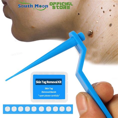 south moon skin tag remover band warts removal rubber band adult remover kit with cleansing pads