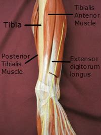 It can cause joint pain, stiffness, and affect how a tendon moves. Shin Splints Causes & Treatment AZ