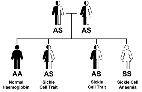 Sickle Cell Anaemia Geeky Medics
