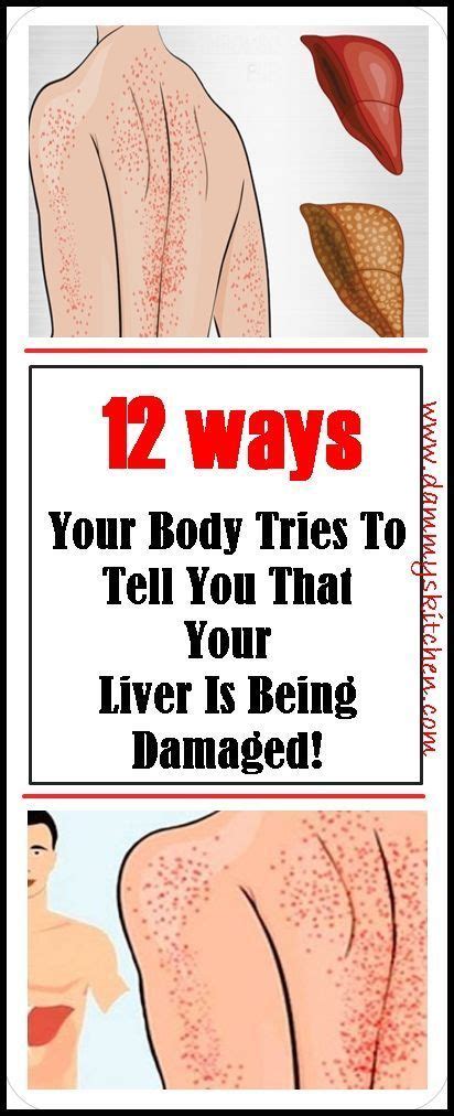 Our Liver Is The Vital Organ Located In The Right Upper