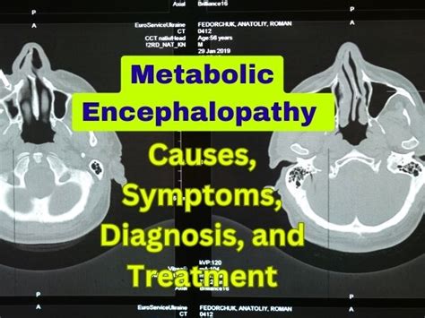 Metabolic Encephalopathy Causes Symptoms Diagnosis And Treatment