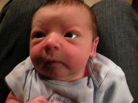 Cross Eyed Baby Jackson Eldridge Flickr