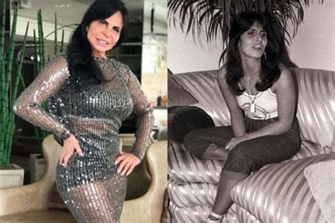 Gretchen Miranda antes e depois da fama e procedimentos estéticos