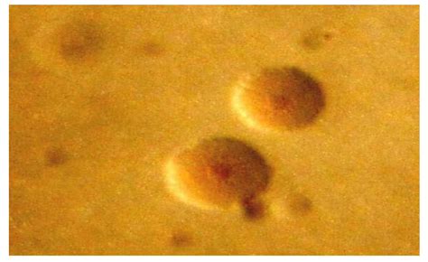 Prevalence Of Mycoplasma Hominis Infection In Pregnant Women With An