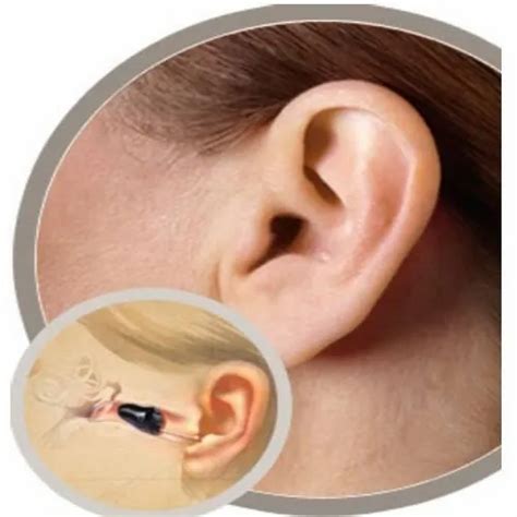 Iic Hearing Aids At Rs 25000 Hearing Aids In Hyderabad Id 16029587748