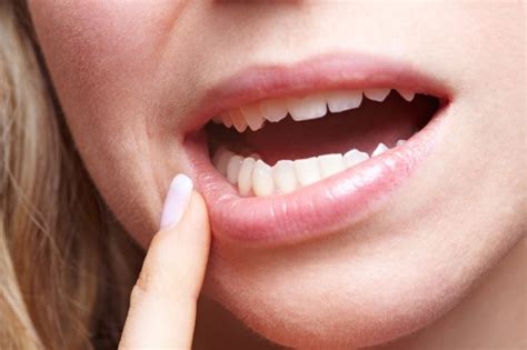 Receding Gums How To Treat A Common Condition University Health News