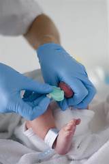 Low Blood Sugar In Newborns Treatment