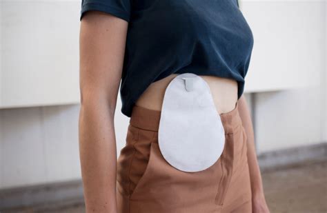 Teddy Schuyers Guts Proposes Redesigning The Ostomy Bag For Sex Sport