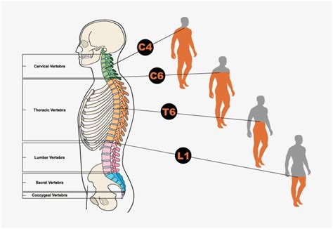 Diagram Showing Different Types Of Spinal Cord Injuries Illustration