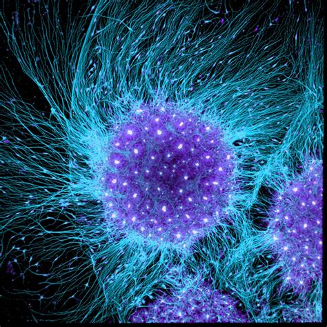 An Image Of Human Neural Rosette Primordial Brain Cells Differentiated