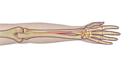 Tendon, tissue that attaches a muscle to other body parts, usually bones. Muscle Test and Tendon Exam: Extensor Pollicis Longus (EPL ...