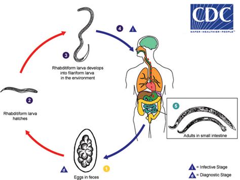 Cdc Dpdx Trichostrongylosis Index