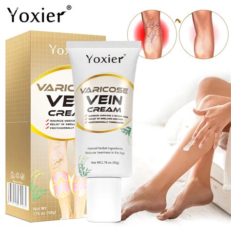 Crème réparatrice pour varices et phlébite Test et Avis