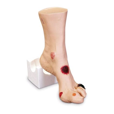 Wound Foot Wilma Sports Supports Mobility Healthcare Products