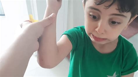 Efenin kolu yaralandı sarı yarabandı yapıştırdık YouTube