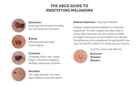 Melanoma Symptoms Abcd Guide Utah Valley Dermatology