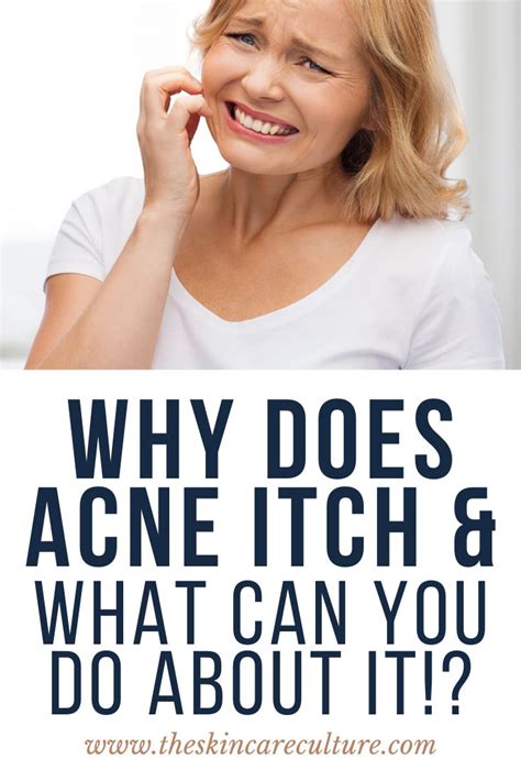 Does Your Acne Itch Heres How To Deal Clearlyderm Acne Acne