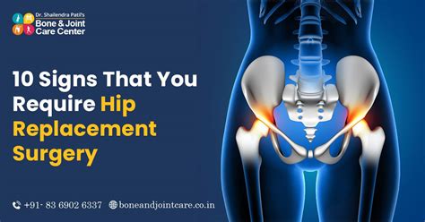 10 Signs That You Require Hip Replacement Surgery In Mumbai