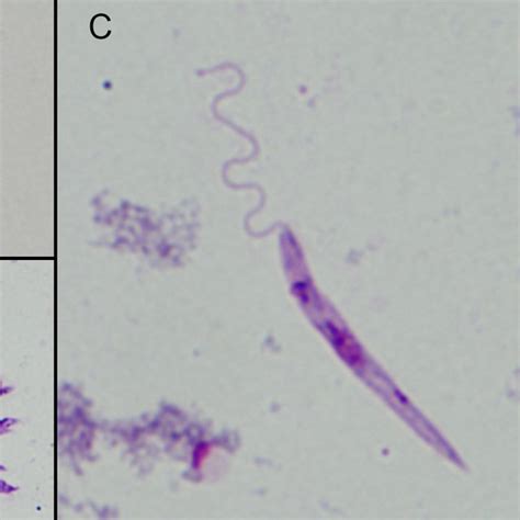 Morphological Forms Determined In Midgut Smears Leishmania Parasites Download Scientific