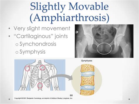 Ppt Joints Of The Human Body Powerpoint Presentation Free Download