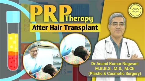 Prp Hair Treatment Prp Hair Loss Treatment Before And After Prp