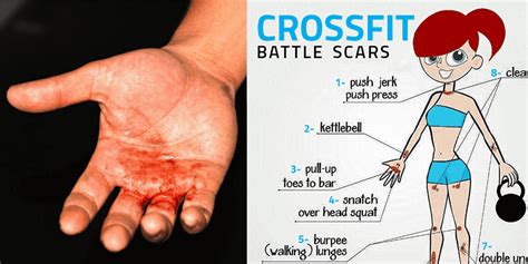 8 Injuries That Every Crossfit Athlete Will Understand Boxrox