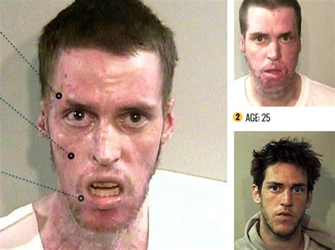 The Horror Of Meth Before And After Pictures Reveal S