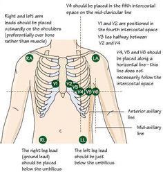 And within 1 min, an. 12 lead ecg placement mnemonic - Google Search | science ...