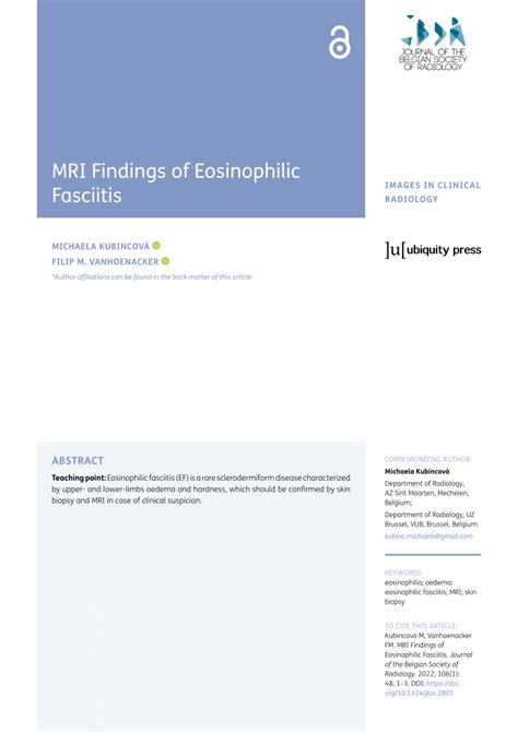 Pdf Mri Findings Of Eosinophilic Fasciitis