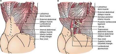 Abdominal Wall Hernias Basicmedical Key