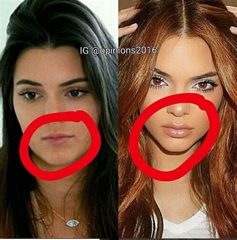 kendall jenner before and after archives ghanacelebrities