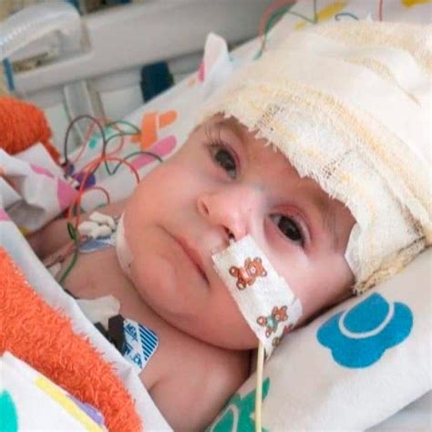 Baby Born With 3 Arms And Half A Heart To Undergo Numerous Surgeries In