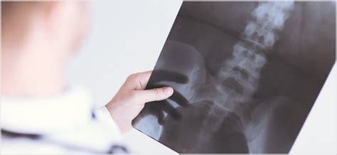 The easiest method to discover in case your insurance covers chiropractic care and also to discover what restrictions can be found, would be to contact work you need to visit. Does Medicare Cover Chiropractic Care? - Medicare Insurance AZ