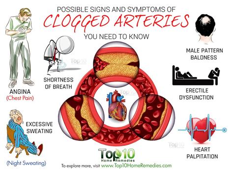 10 Possible Signs And Symptoms Of Clogged Arteries You Need To Know