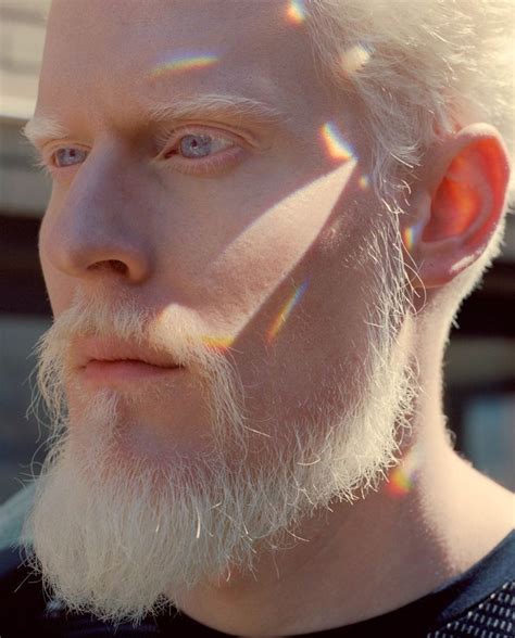 Albino Love Albino Model Albino Men Stephen Thompson
