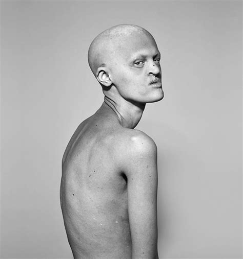 Mulahola Meet Melanie Gaydos 28 Year Old Model With A Rare Genetic Disorder Who Broke All