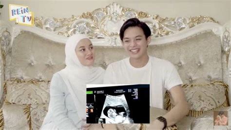 Selamat Dinda Hauw Hamil Anak Pertama Pamer Video Usg Buah Hati