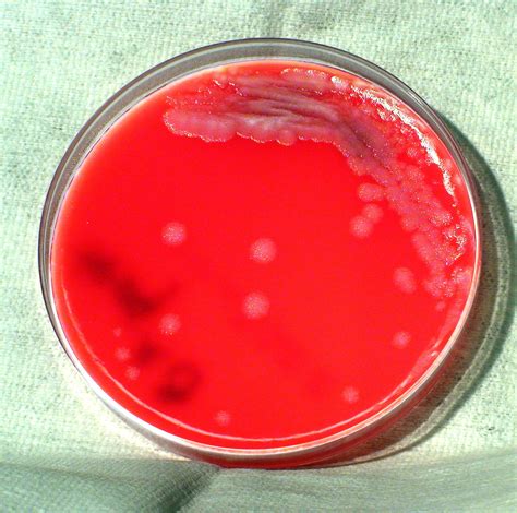 Free Picture Bacillus Anthracis Bacteria Grown Phenylethyl