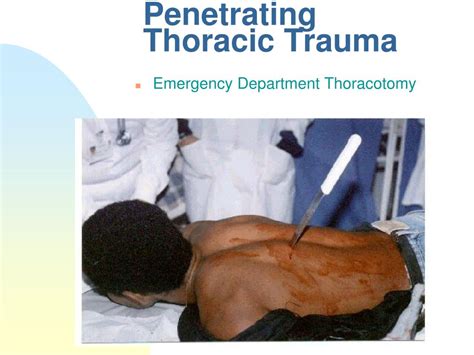 Ppt Trauma Overview Powerpoint Presentation Free Download Id2961573