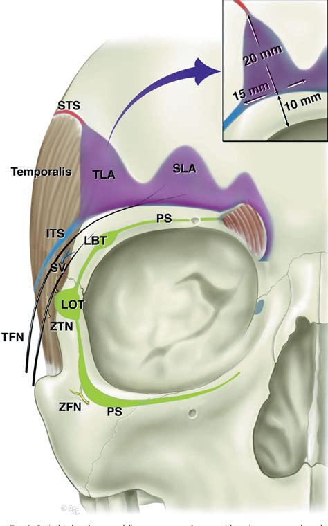 Pdf Surgical Anatomy Of The Ligamentous Attachments In The Temple And